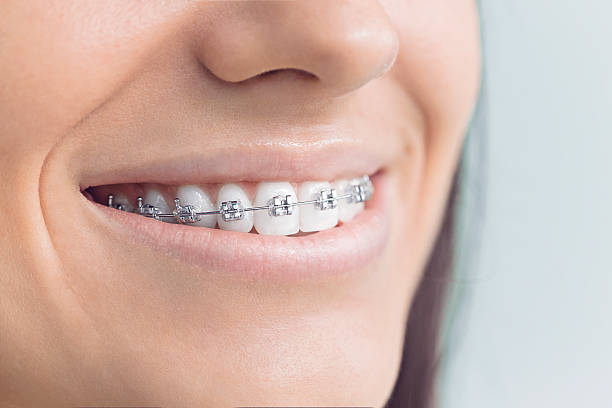 Best Teeth Whitening  in Notasulga, AL